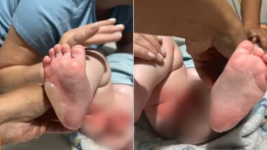 Bebê sofre queimaduras durante banho em berçário: incidente alarmante.