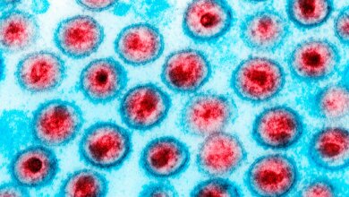 Paciente Alcança Remissão do HIV Após Transplante de Medula Óssea de Irmão